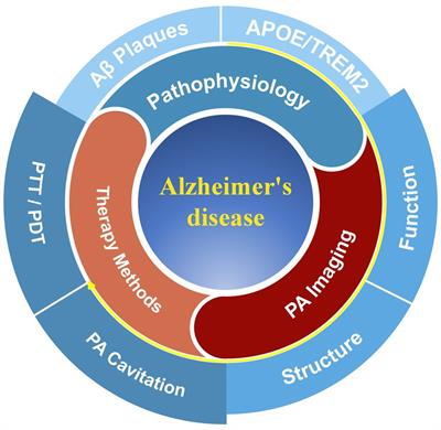 Light on Alzheimer’s disease: from basic insights to preclinical studies